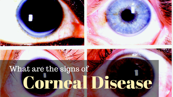 corneal-disease